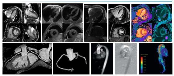 心脏一站式MR检查